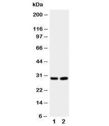 Western blot testing of Prion protein antibody and Lane 1: rat brain; 2: rat brain. Expected molecul