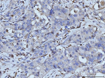 PLD3 Antibody / 5-3 exonuclease PLD3