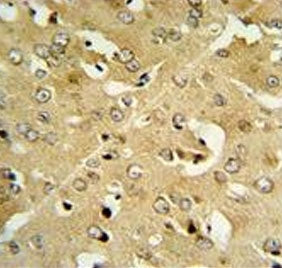 Corticotropin-releasing factor receptor 2 Antibody / CRHR2