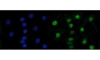 RAD50 Antibody