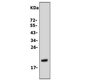 Western blot testing of human U-2 OS cell lysate with Fibroblast Growth Factor 7 antibody. Predicted