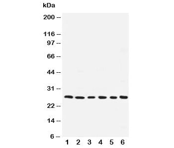 ARC Antibody Apoptosis Repressor with CARD
