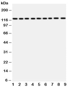 Western blot testing of TRPC3 antibody and Lane 1: rat liver; 2: (r) lung; 3: (r) intestine; 4: (r) 