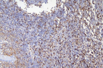 IHC staining of FFPE human tonsil with CD5 antibody. HIER: boil tissue sections in pH6, 10mM citrate