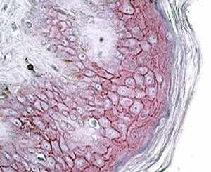 IHC testing of FFPE human skin with Desmoglein antibody at 4ug/ml. HIER: steamed with pH6 citrate bu