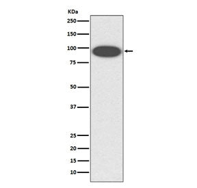 Western blot testing of human K562 cell lysate with ITGB2 antibody. Expected molecular weight: 85~95