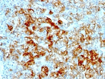 Cadherin 16 Antibody