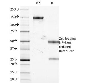 TNF alpha Antibody