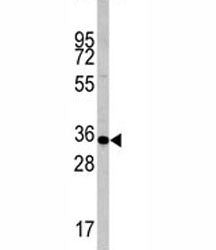 Caspase-6 Antibody, 0.08ml