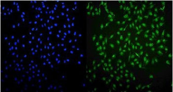 Immunofluorescent staining of FFPE human U-2 OS cells with UHRF1 antibody (green) and DAPI nuclear s