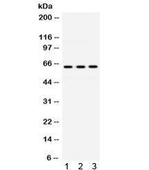 Western blot testing of human 1) HeLa, 2) Jurkat and 3) HUT lysate with EME1 antibody. Expected mole