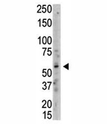 Western blot analysis of PRMT3 antibody and whole HL-60 cell lysate. Predicted molecular weight: 55-
