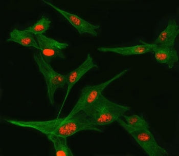 TSEN34 Antibody / tRNA-splicing endonuclease subunit Sen34