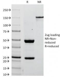 Placental Alkaline Phosphatase Antibody / ALPP