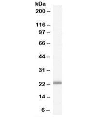 Western blot testing of human liver lysate with RBP4 antibody at 0.3ug/ml. Predicted molecular weigh