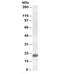 CLEC4C Antibody