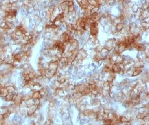 Cadherin 16 Antibody