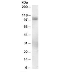 Western blot testing of human lung lysate with PDE5 antibody at 0.3ug/ml. Predicted molecular weight
