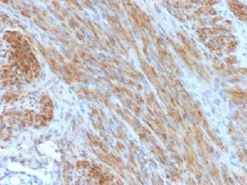 Desmin Antibody (Muscle cell marker)