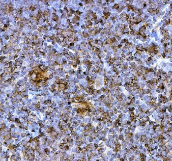 IHC staining of FFPE rat thymus tissue with Pdcd1 antibody. HIER: boil tissue sections in pH8 EDTA f
