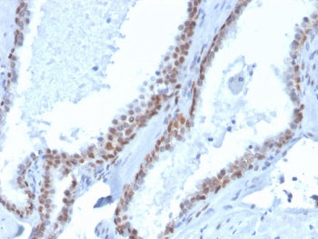 IHC staining of FFPE human prostate with biotinylated recombinant p40 antibody (clone rTP40/3690). H