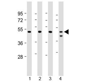 Western blot testing of human 1) Jurkat, 2) U-2 0S, 3) HeLa and 4) MCF7 cell lysate with PSMC2 antib