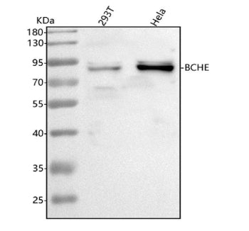 Western blot analysis of BCHE using anti-BCHE antibody. Lane 1: human 293T whole cell lysates, Lane 