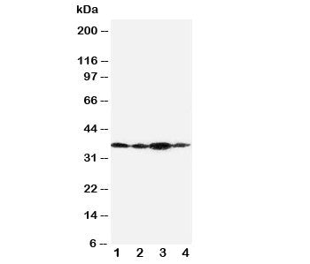 Western blot testing of Podoplanin antibody and Lane 1: SMMC-7721; 2: 293T; 3: HeLa. Predicted molec
