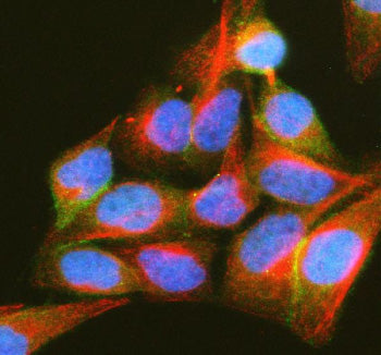 Immunofluorescent staining of PIP5K1A using anti-PIP5K1A antibody (green) and anti-Beta Tubulin anti