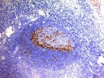 PDCD1 Antibody / PD-1 / PD1