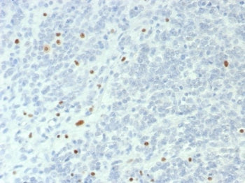 BRG1 Antibody / SMARCA4