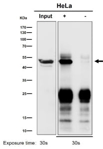 Immunoprecipitation analysis using the ACTR1B antibody at 1:50 dilution. Western blot at 1:500 dilut