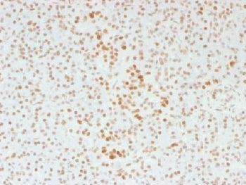 IHC testing of FFPE human pancreas with ATRX antibody (clone 39f). Required HIER: steam section in p