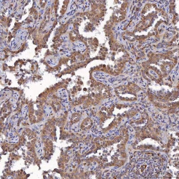 SAV1 Antibody / Protein salvador homolog 1 / WW45
