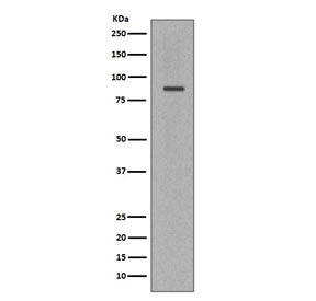 Western blot testing of human Jukat cell lysate with Cleaved PARP antibody. Predicted molecular weig
