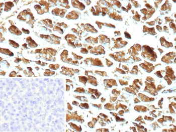 IHC staining of FFPE human pancreas tissue with recombinant CPA1 antibody (clone CPA1/9622R). Inset: