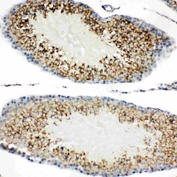 TIM-1 Antibody (KIM-1)