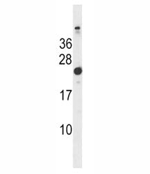 Hras1 antibody western blot analysis in mouse bladder tissue lysate. Predicted molecular weight ~ 21