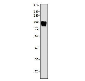 Western blot testing of human K562 cell lysate with Argonaute 3 antibody. Predicted molecular weight