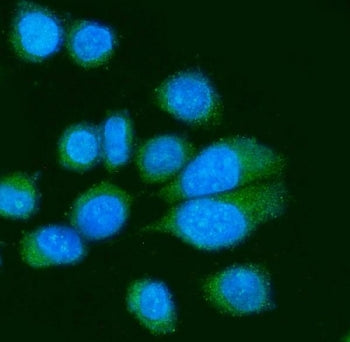 Immunofluorescent staining of FFPE human SiHa cells with CD155 antibody (green) and DAPI nuclear sta