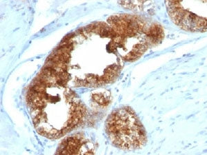 TAG-72 Antibody Cocktail