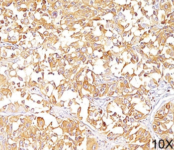 PMEL17 / Melanoma gp100 Antibody
