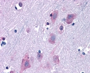 IHC staining of FFPE human cortex with TRIM2 antibody at 6.3ug/ml. HIER: steamed with pH6 citrate bu