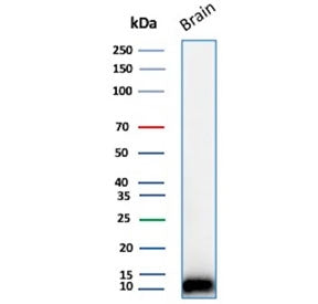 Western blot testing of human brain tissue lysate using S100B antibody (clone 4C4.9). Predicted mole