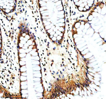Immunohistochemical staining of NAV1 using anti-NAV1 antibody. NAV1 was detected in a paraffin-embed