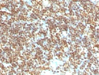 IHC testing of FFPE human tonsil with dsDNA antibody (clone DRNC1-1). FFPE testing requires sections