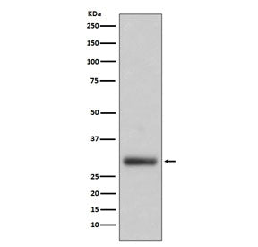 Western blot testing of human HL60 cell lysate with Neutrophil Elastase antibody. Expected molecular
