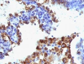 Napsin A Antibody Cocktail