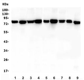 Western blot testing of rat 1) heart, 2) kidney, 3) liver, 4) spleen and mouse 5) heart, 6) kidney, 