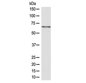 Western blot testing of human Jurkat lysate with CDC45 antibody at 0.5ug/ml. Predicted molecular wei